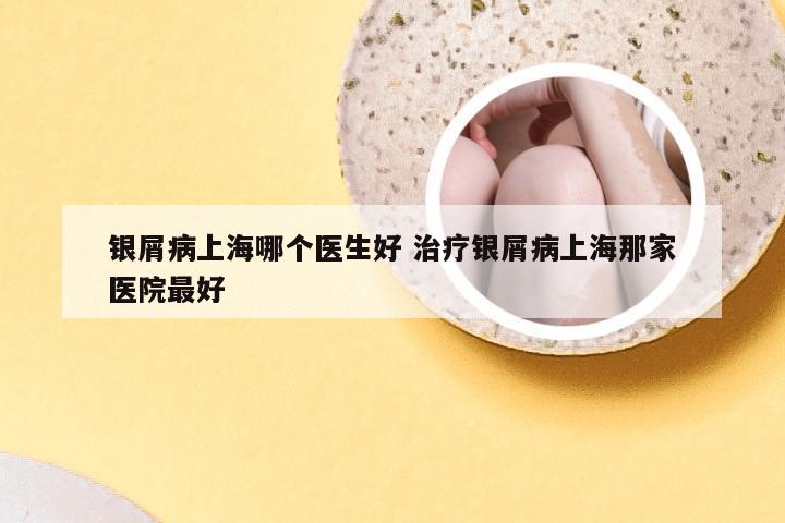 银屑病上海哪个医生好 治疗银屑病上海那家医院最好
