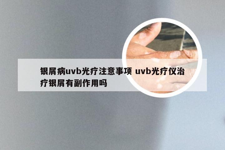 银屑病uvb光疗注意事项 uvb光疗仪治疗银屑有副作用吗