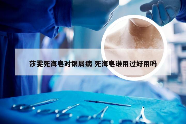 莎雯死海皂对银屑病 死海皂谁用过好用吗