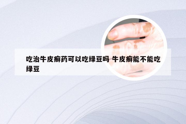 吃治牛皮癣药可以吃绿豆吗 牛皮癣能不能吃绿豆