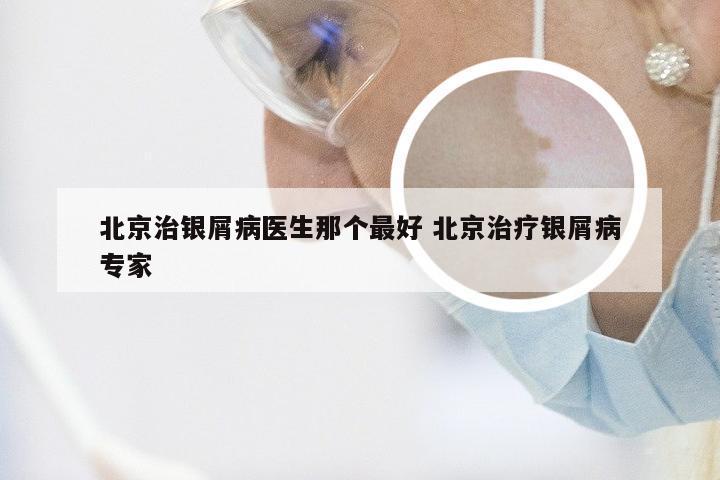 北京治银屑病医生那个最好 北京治疗银屑病专家