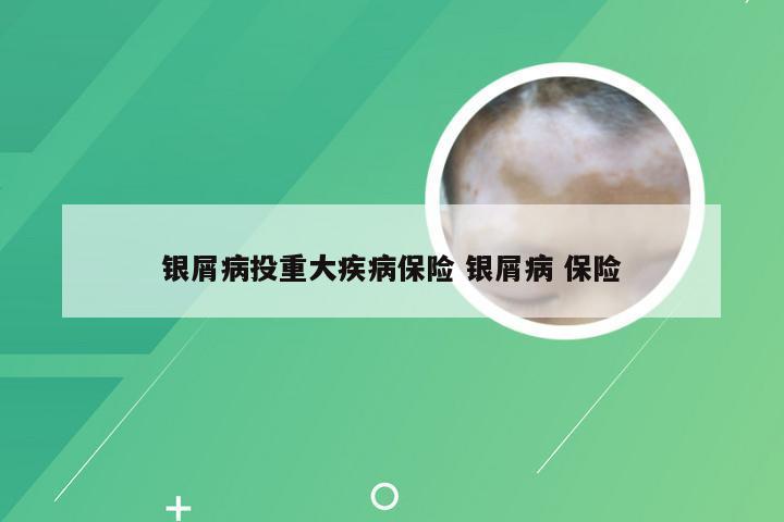 银屑病投重大疾病保险 银屑病 保险