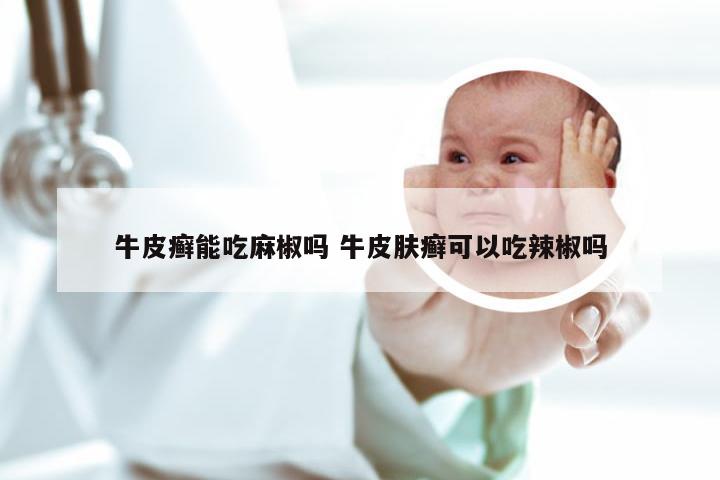 牛皮癣能吃麻椒吗 牛皮肤癣可以吃辣椒吗