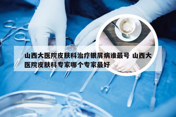 山西大医院皮肤科治疗银屑病谁最号 山西大医院皮肤科专家哪个专家最好