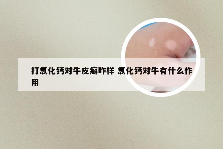 打氯化钙对牛皮癣咋样 氯化钙对牛有什么作用