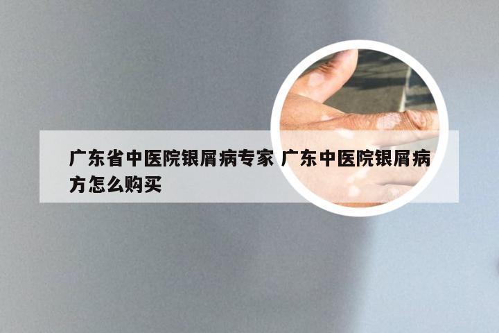 广东省中医院银屑病专家 广东中医院银屑病方怎么购买