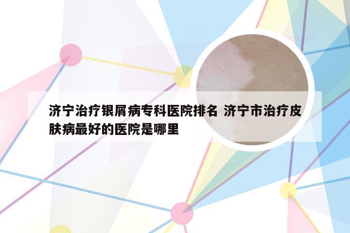 济宁治疗银屑病专科医院排名 济宁市治疗皮肤病最好的医院是哪里