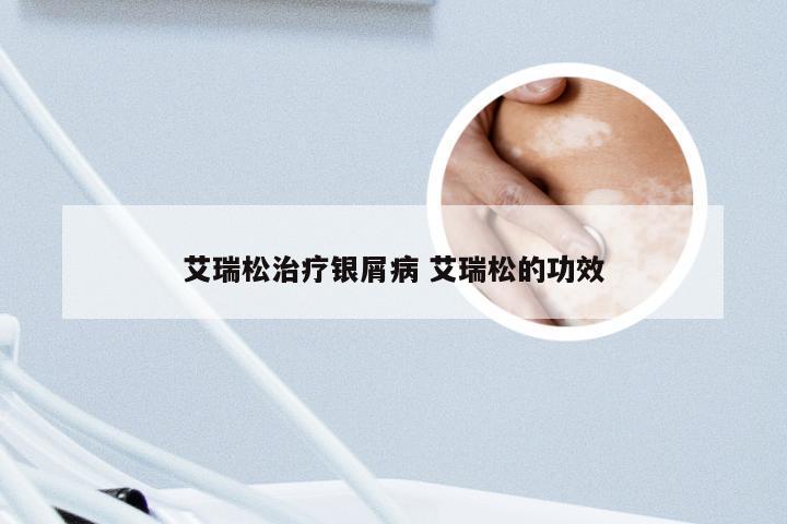 艾瑞松治疗银屑病 艾瑞松的功效