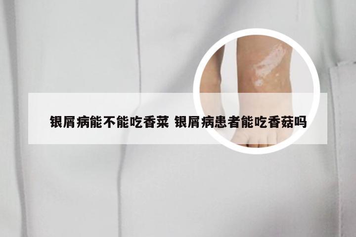 银屑病能不能吃香菜 银屑病患者能吃香菇吗
