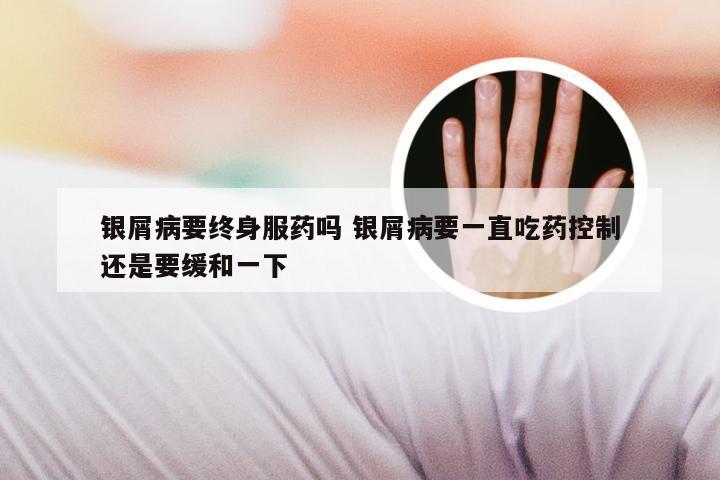 银屑病要终身服药吗 银屑病要一直吃药控制还是要缓和一下