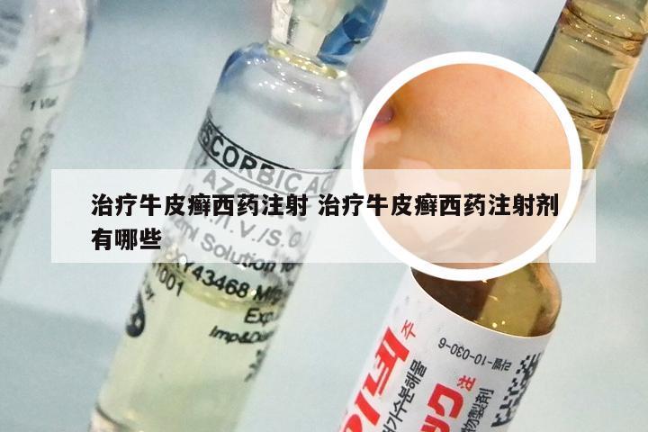 治疗牛皮癣西药注射 治疗牛皮癣西药注射剂有哪些