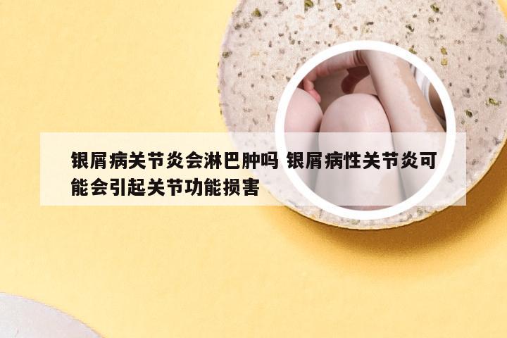 银屑病关节炎会淋巴肿吗 银屑病性关节炎可能会引起关节功能损害