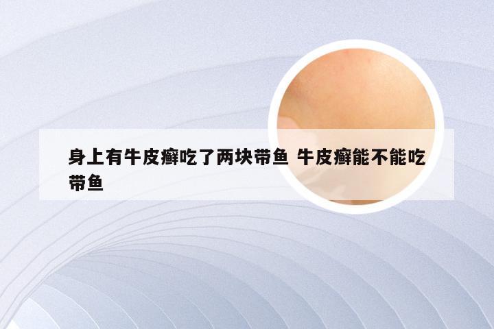 身上有牛皮癣吃了两块带鱼 牛皮癣能不能吃带鱼