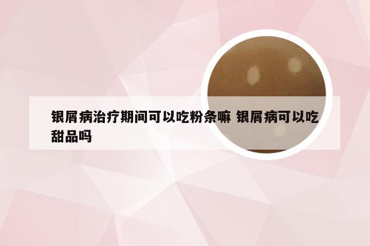 银屑病治疗期间可以吃粉条嘛 银屑病可以吃甜品吗
