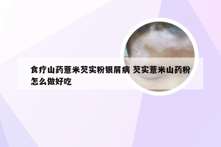 食疗山药薏米芡实粉银屑病 芡实薏米山药粉怎么做好吃