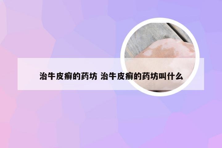 治牛皮癣的药坊 治牛皮癣的药坊叫什么