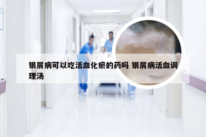 银屑病可以吃活血化瘀的药吗 银屑病活血调理汤