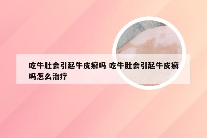 吃牛肚会引起牛皮癣吗 吃牛肚会引起牛皮癣吗怎么治疗