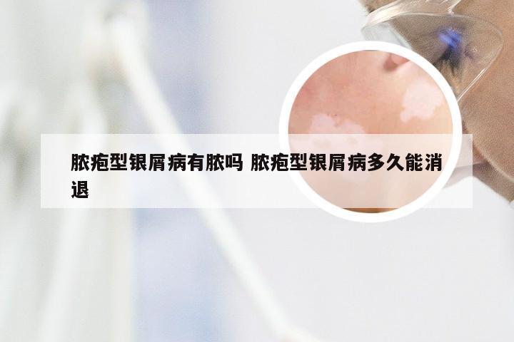 脓疱型银屑病有脓吗 脓疱型银屑病多久能消退