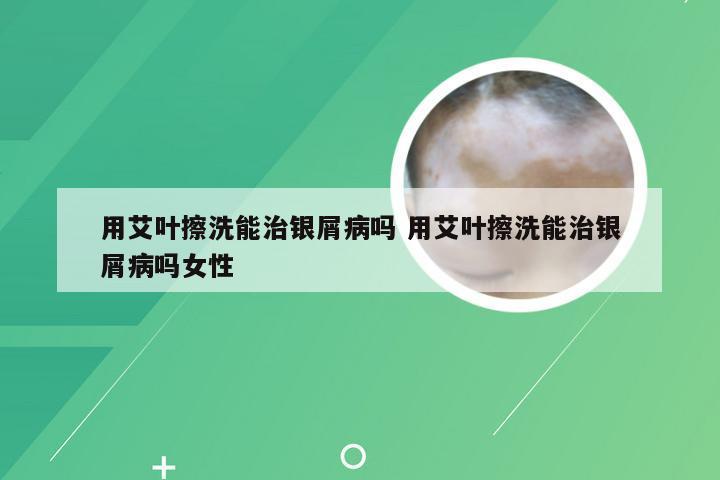 用艾叶擦洗能治银屑病吗 用艾叶擦洗能治银屑病吗女性