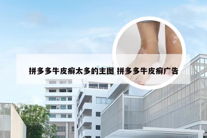 拼多多牛皮癣太多的主图 拼多多牛皮癣广告