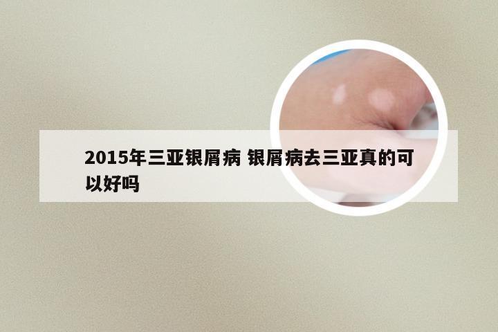 2015年三亚银屑病 银屑病去三亚真的可以好吗