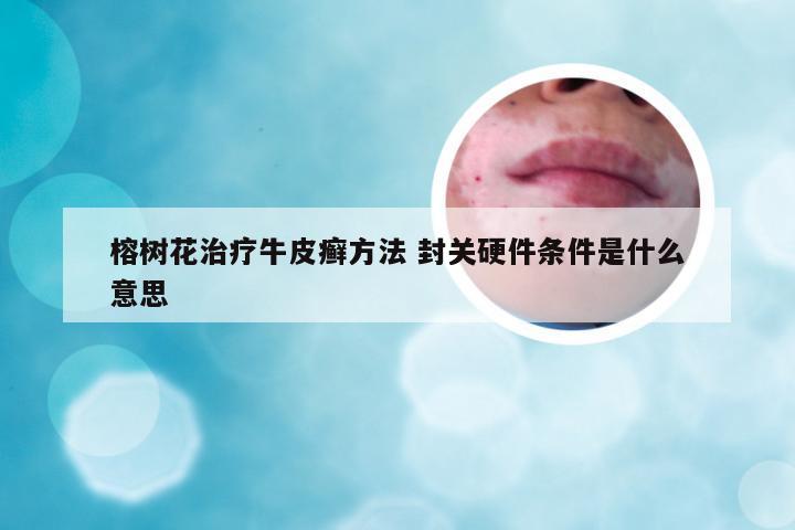 榕树花治疗牛皮癣方法 封关硬件条件是什么意思