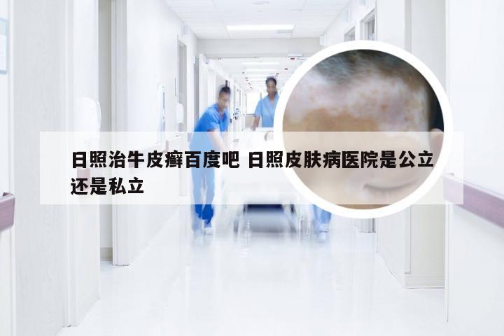 日照治牛皮癣百度吧 日照皮肤病医院是公立还是私立