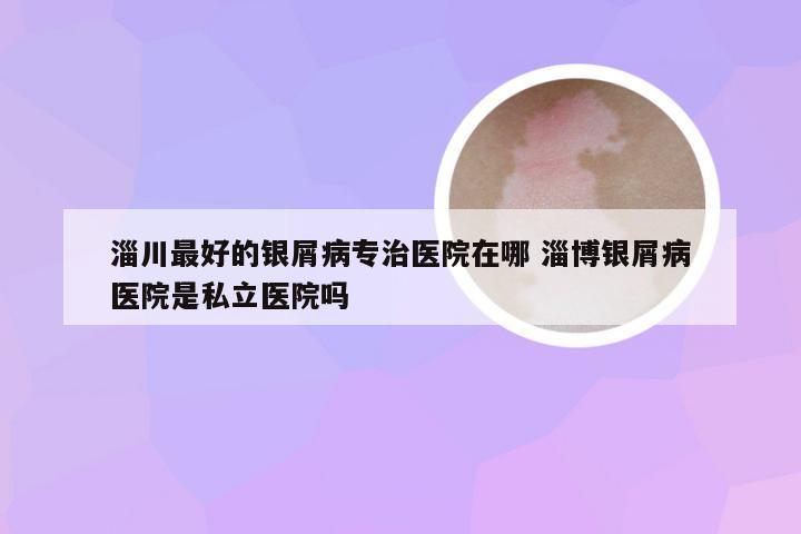 淄川最好的银屑病专治医院在哪 淄博银屑病医院是私立医院吗
