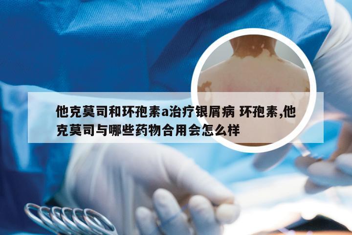 他克莫司和环孢素a治疗银屑病 环孢素,他克莫司与哪些药物合用会怎么样