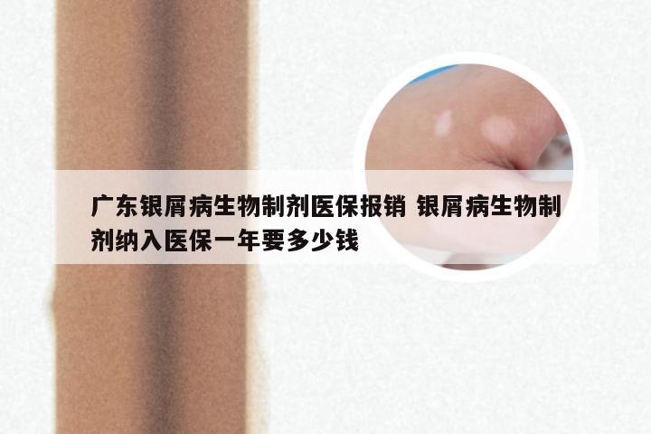 广东银屑病生物制剂医保报销 银屑病生物制剂纳入医保一年要多少钱