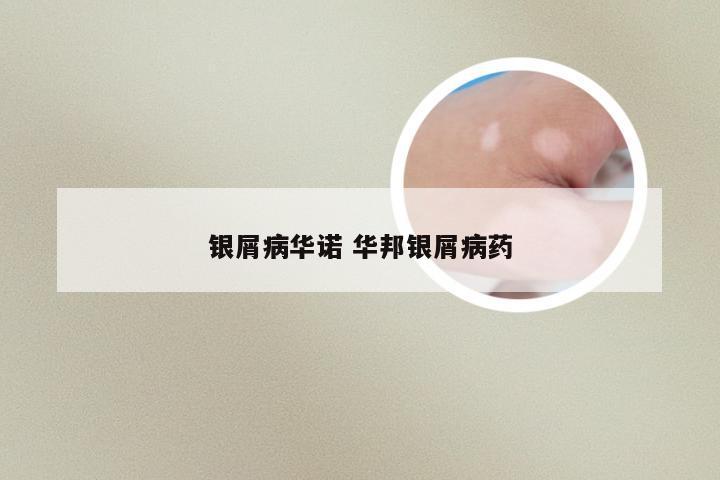 银屑病华诺 华邦银屑病药