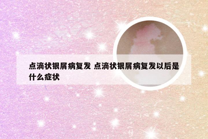 点滴状银屑病复发 点滴状银屑病复发以后是什么症状