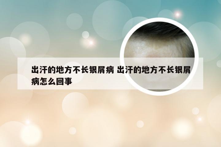 出汗的地方不长银屑病 出汗的地方不长银屑病怎么回事