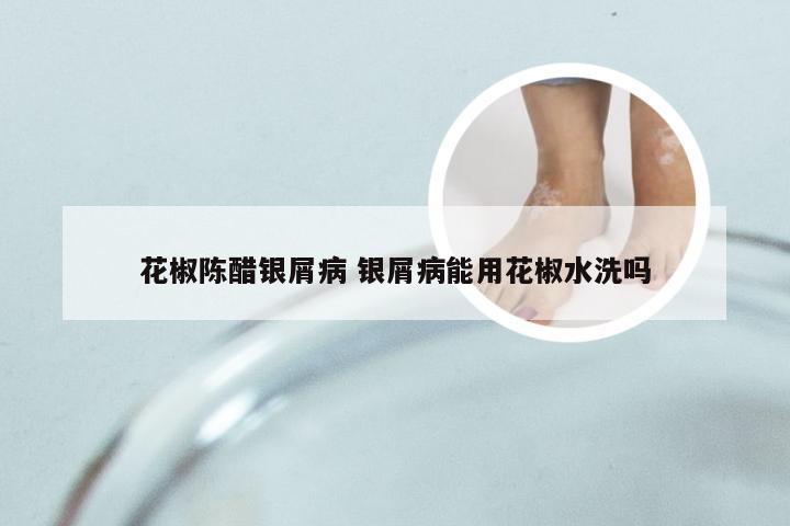 花椒陈醋银屑病 银屑病能用花椒水洗吗