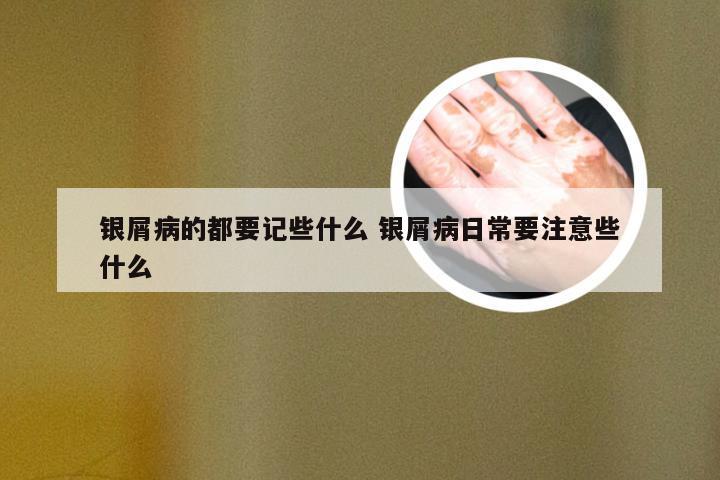 银屑病的都要记些什么 银屑病日常要注意些什么