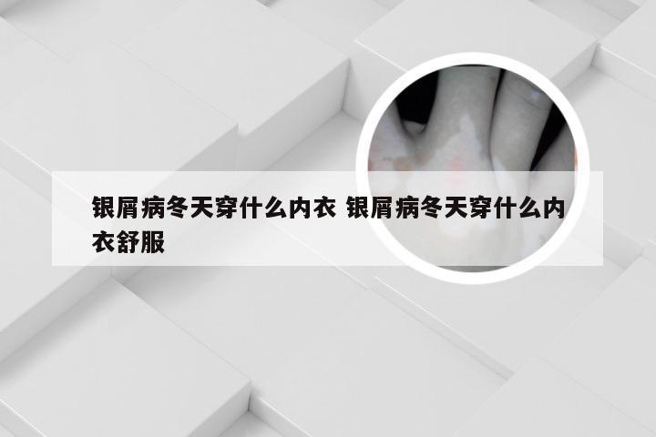 银屑病冬天穿什么内衣 银屑病冬天穿什么内衣舒服