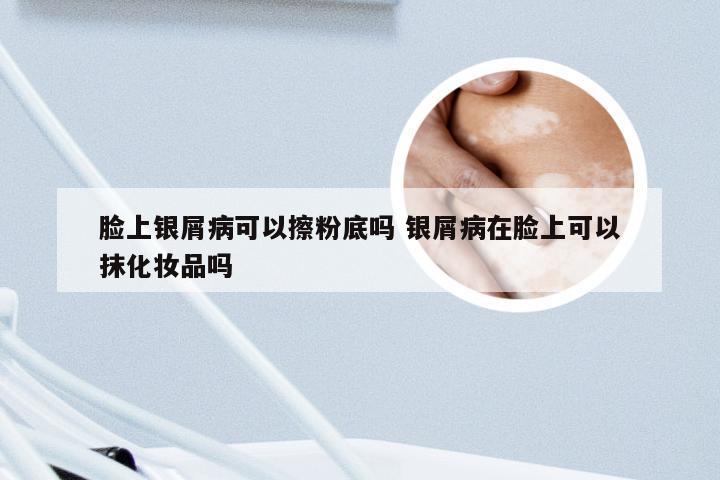 脸上银屑病可以擦粉底吗 银屑病在脸上可以抹化妆品吗
