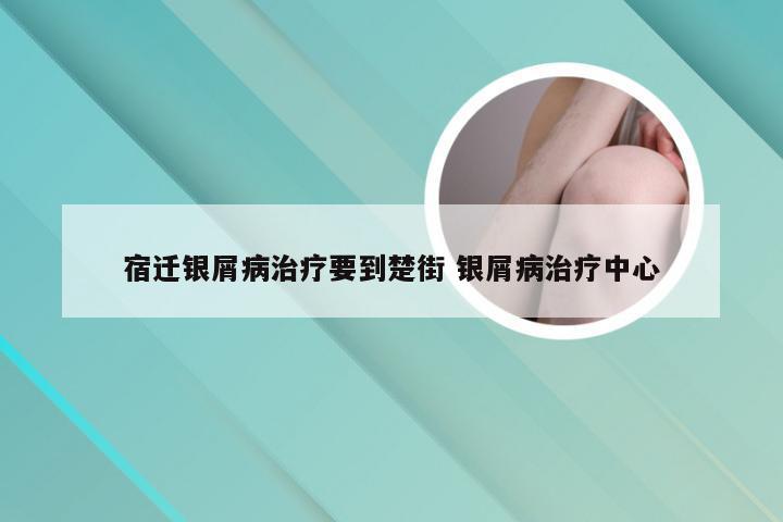 宿迁银屑病治疗要到楚街 银屑病治疗中心