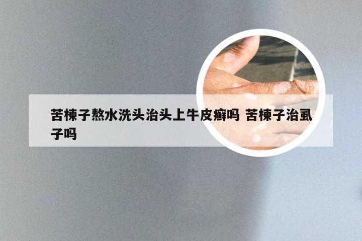 苦楝子熬水洗头治头上牛皮癣吗 苦楝子治虱子吗