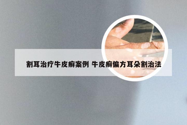 割耳治疗牛皮癣案例 牛皮癣偏方耳朵割治法