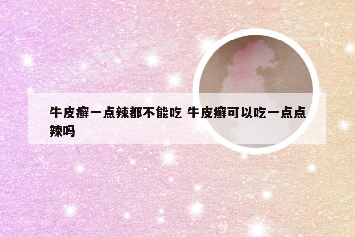 牛皮癣一点辣都不能吃 牛皮癣可以吃一点点辣吗