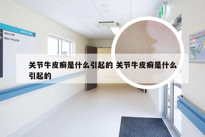 关节牛皮癣是什么引起的 关节牛皮癣是什么引起的