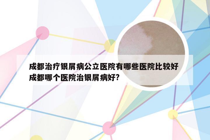 成都治疗银屑病公立医院有哪些医院比较好 成都哪个医院治银屑病好?