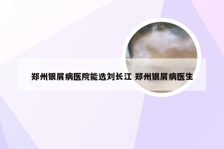 郑州银屑病医院能选刘长江 郑州银屑病医生