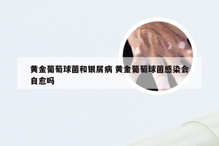 黄金葡萄球菌和银屑病 黄金葡萄球菌感染会自愈吗