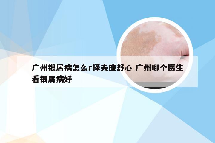 广州银屑病怎么r择夫康舒心 广州哪个医生看银屑病好