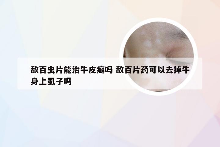 敌百虫片能治牛皮癣吗 敌百片药可以去掉牛身上虱子吗