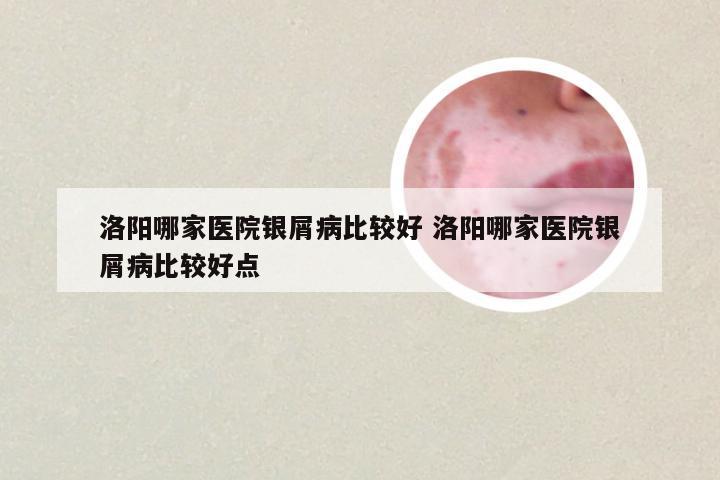洛阳哪家医院银屑病比较好 洛阳哪家医院银屑病比较好点