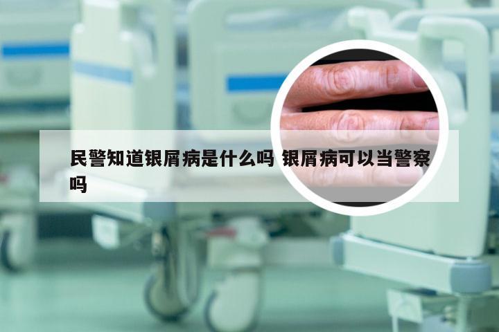 民警知道银屑病是什么吗 银屑病可以当警察吗